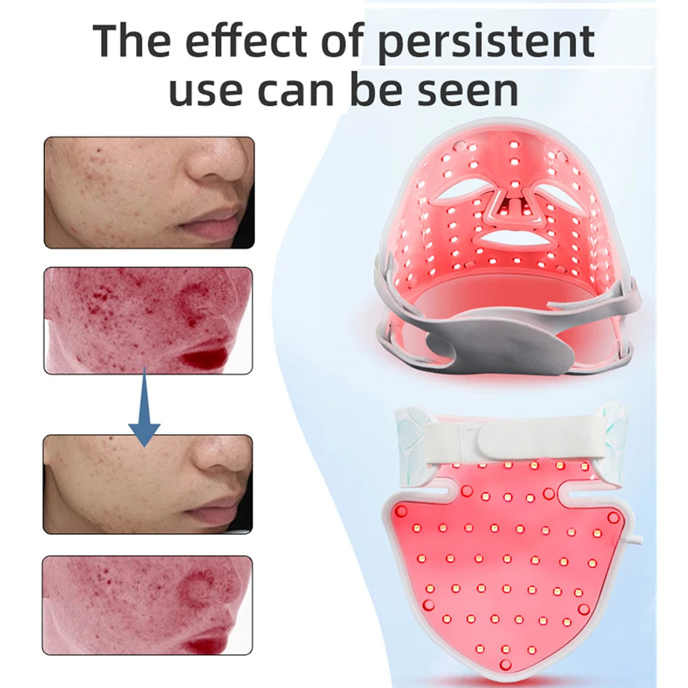 Comnox - LED Gezichtsmasker en Nekset - 7 Kleuren + Infrarood Licht - Anti-Aging, Acne Therapie, Rimpelvermindering - Draagbaar en Oplaadbaar - Bruin - Comnox Company